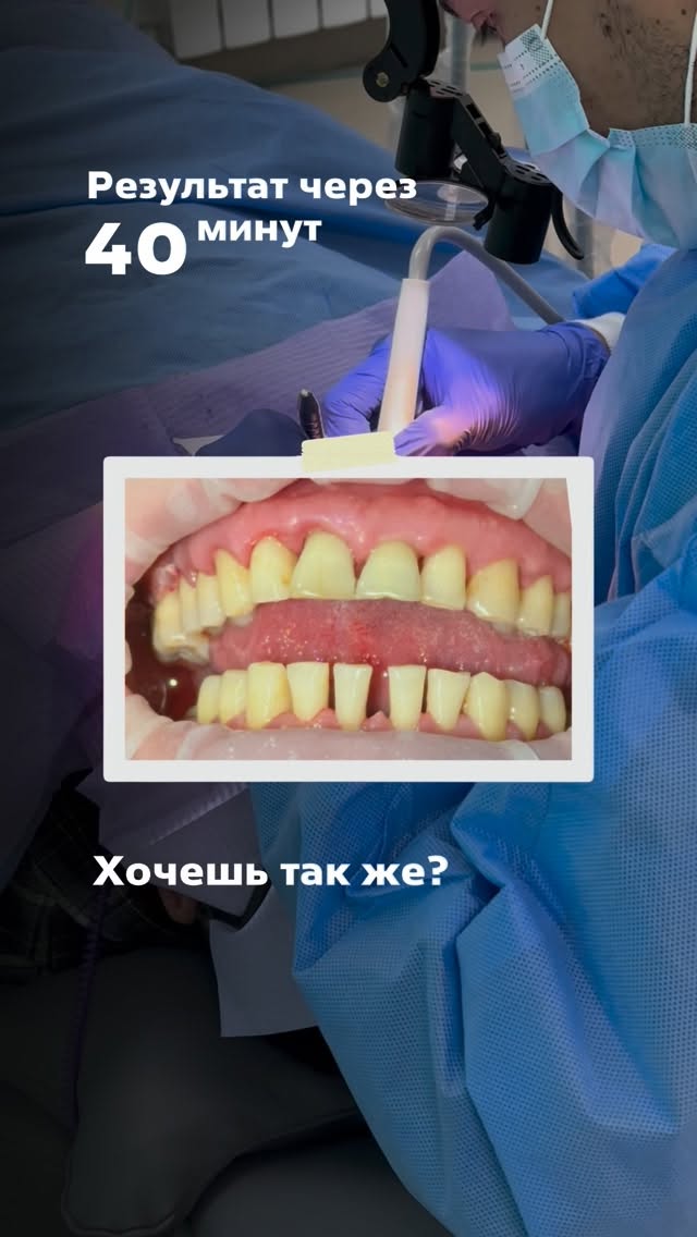 Профессиональная чистка